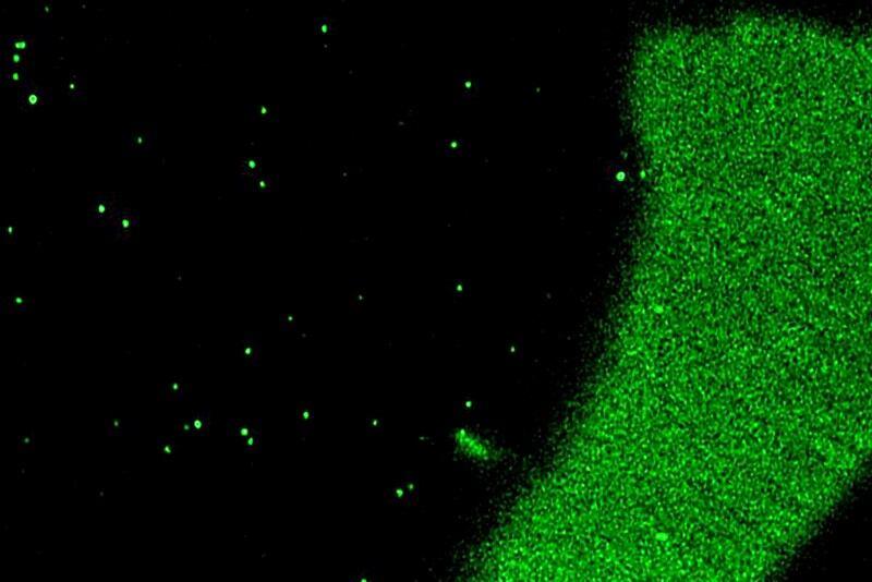 microscopic image of vesicles